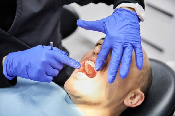 Best Teeth Whitening  in Midway North, TX